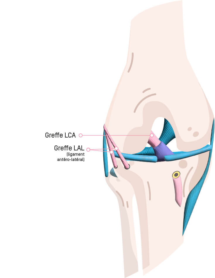 Ligament_3