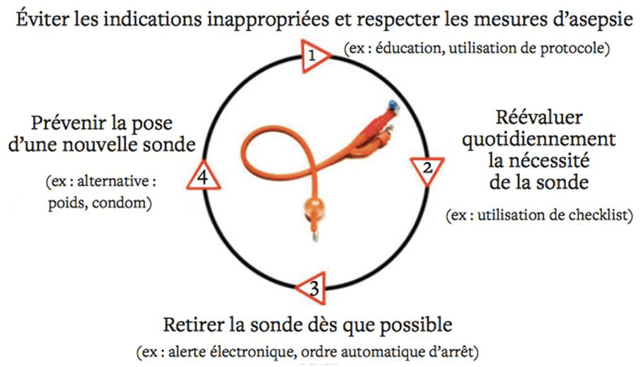 Pose d'une sonde urinaire - Revinax