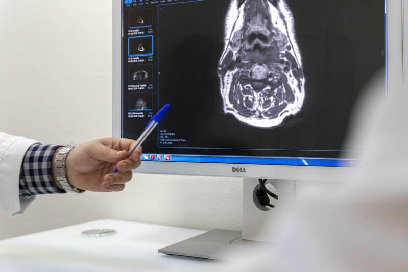 La neuroradiologie_Hôpital_de_la_Tour